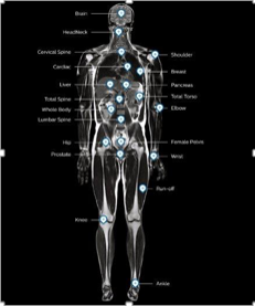 MR body map fieldstrength