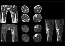 clinical cases 1 femur