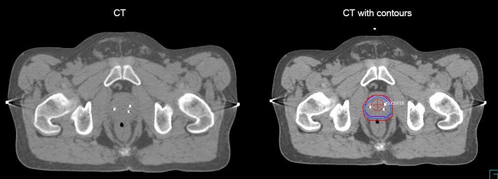 fieldstrength ingenia clinical case 2 2