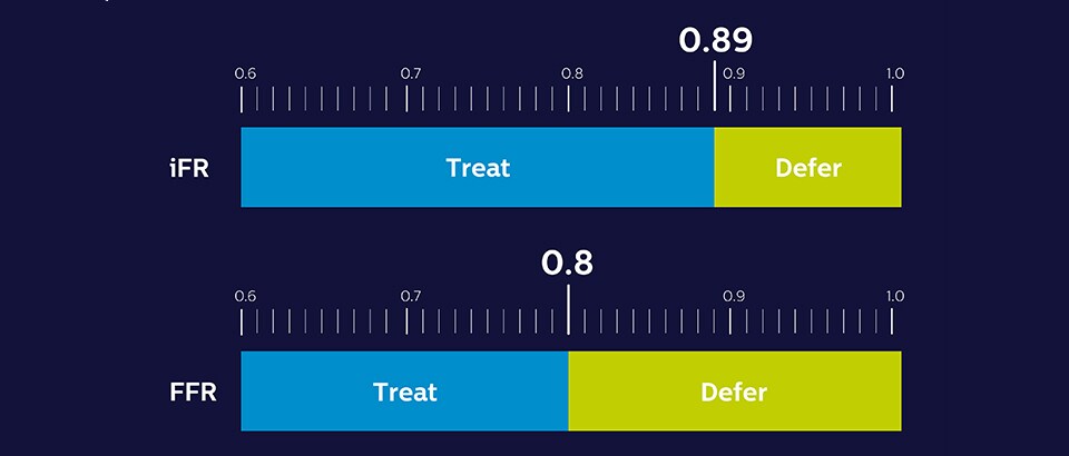 Diagram treat and defer