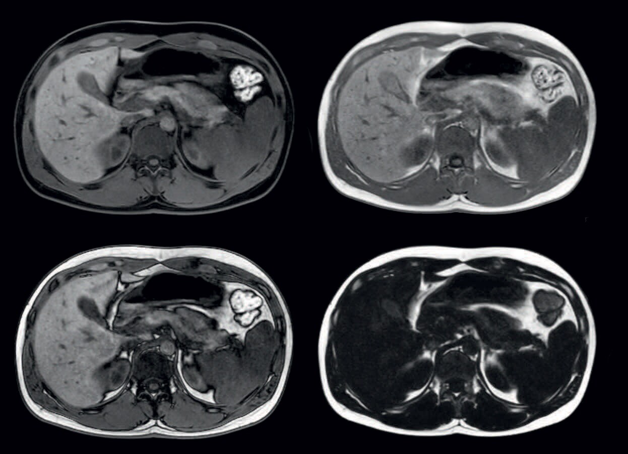 Clinical images ingenia 15ts MRI system